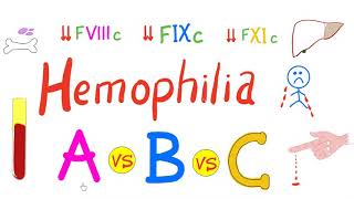 Hemophilia Types  hemophilia A Hemophilia B and Hemophilia C  Comparison  Genetics Hematology [upl. by Ashley]