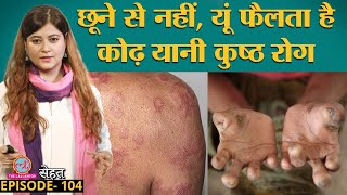 कुष्ठ रोग यानी Leprosy किसे और कैसे हो सकता है यहां जान लीजिए  Sehat ep 104 [upl. by Ronna]