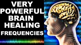 EXTREME BRAIN HEALING FREQUENCIES FOR STUDY FOCUS MIND POWER CONFIDENCE MEDITATION  MUST TRY [upl. by Ellinet]