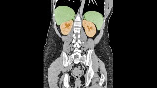 A Student Felt A Sharp Pain In Her Side This Is How Her Organs Shut Down [upl. by Jermaine]