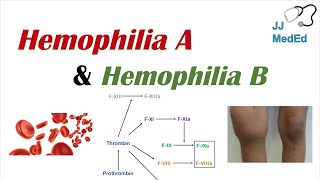 Hemophilia A vs Hemophilia B  Genetics Symptoms and Treatment [upl. by Aronoh]