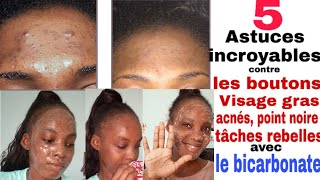 Comment éliminer les boutons tâches points noire visage gras acné avec le bicarbonate 5ASTUCES [upl. by Angeli]