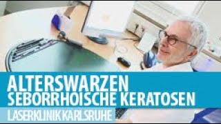 Seborrhoische Keratosen Alterswarzen [upl. by Edlitam245]