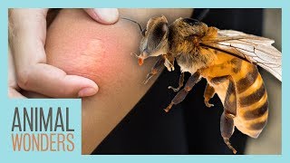 What You Need To Know About Bee Stings [upl. by Herzberg]