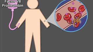 Treating Hemophilia A [upl. by Einobe]