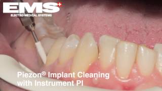 AIRFLOW® amp Piezon® implant cleaning with instrument PI [upl. by Ardnuahsal]