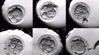 IVF PROCESS STEP BY STEP In Vitro Fertilisation Embryo cultivation [upl. by Kapoor]