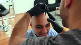 Inside Look Scalp Micropigmentation Treatment  Scalp Micro USA [upl. by O'Malley625]